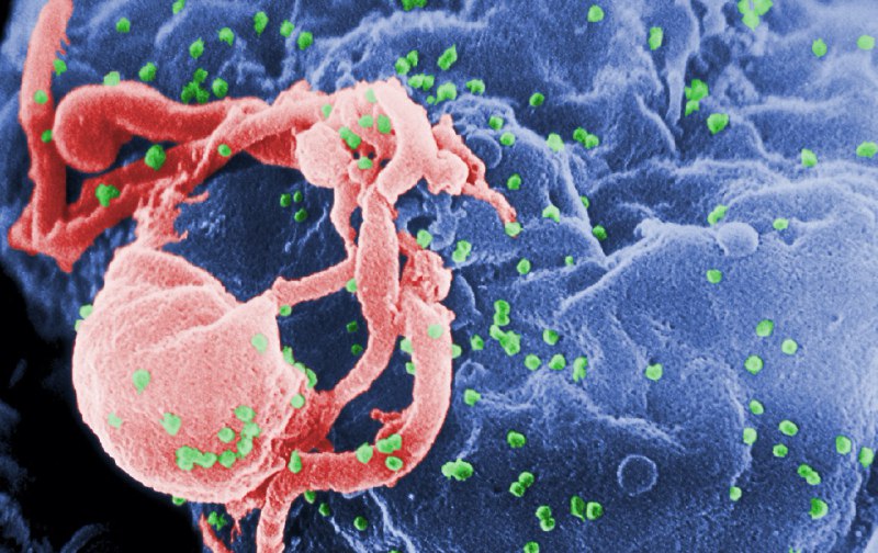 No, the 2019-nCoV genome doesn’t really seem engineered from HIV